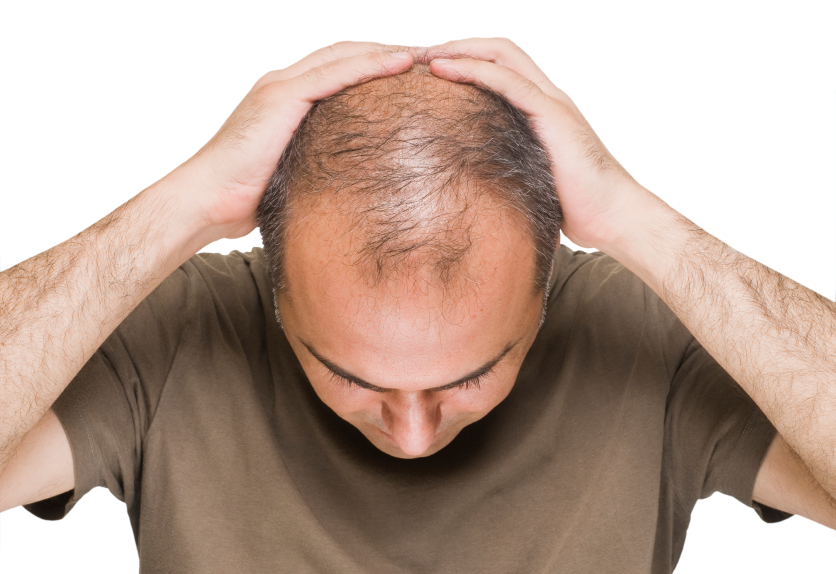 داروی ریزش مو ثبت شده شرکت رویش سبز لاوین