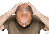 موارد کاربردی و جلوگیری از ریزش مو