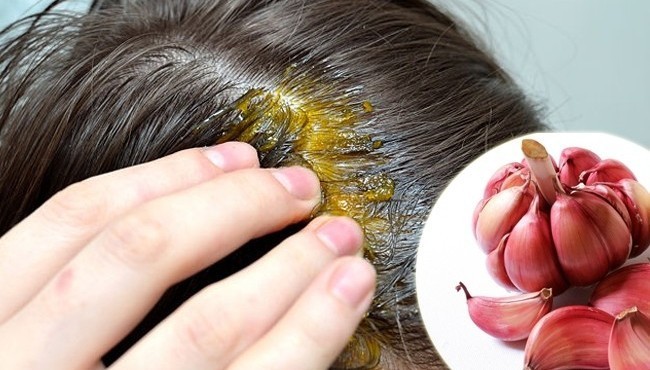 8 درمان طبیعی برای موهای نازک شده