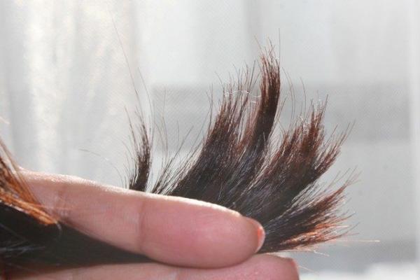 7 روش جلوگیری از موخوره در رشد سریع مو شرکت رویش سبز لاوین
